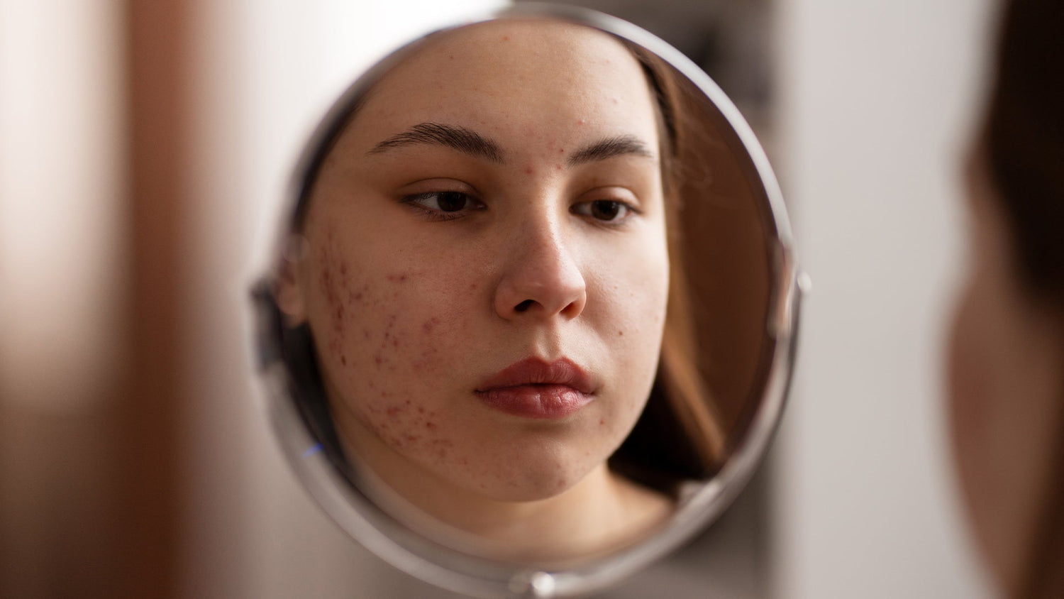 Why Is Your Face Breaking Out?