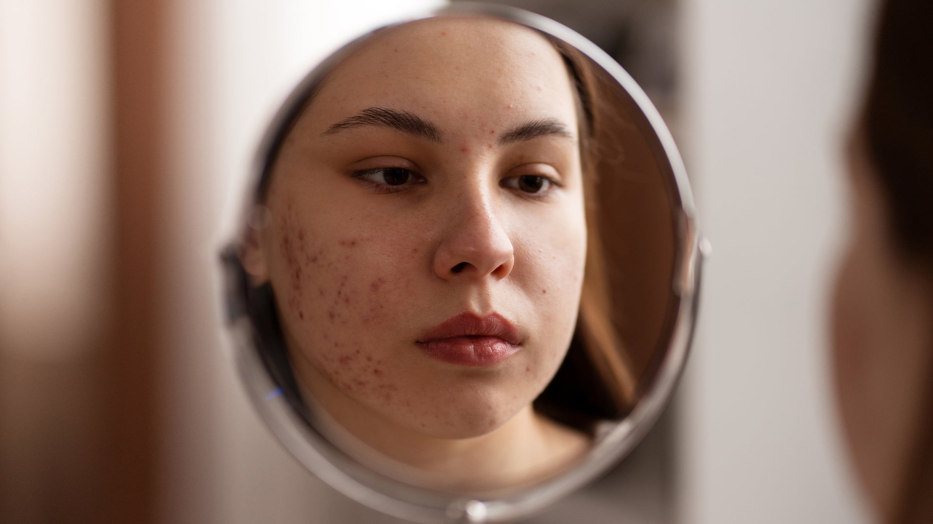 Why Is Your Face Breaking Out?